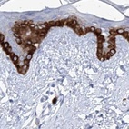 Anti-FRS3 Antibody