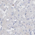 Anti-FRS3 Antibody