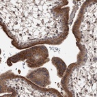 Anti-ZNF25 Antibody