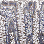 Immunohistochemical staining of human colon shows moderate granular cytoplasmic positivity in glandular cells.