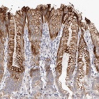 Anti-ZYG11A Antibody