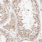 Anti-KIF9 Antibody