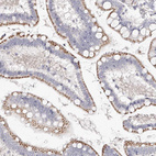 Anti-SLC35D3 Antibody