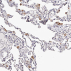 Anti-SLC35D3 Antibody