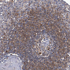 Anti-TNFRSF13B Antibody