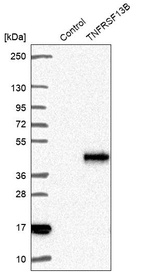 Anti-TNFRSF13B Antibody