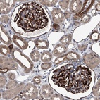 Anti-LDLRAD2 Antibody