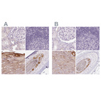 Anti-RPTN Antibody