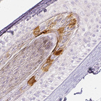 Anti-RPTN Antibody