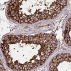 Immunohistochemical staining of human testis shows strong cytoplasmic and membranous positivity in cells in seminiferous ducts.