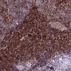 Immunohistochemical staining of human tonsil shows strong cytoplasmic and membranous positivity in non-germinal center cells.