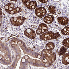 Immunohistochemical staining of human duodenum shows strong cytoplasmic and membranous positivity in glandular cells.