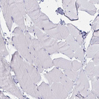 Immunohistochemical staining of human skeletal muscle shows no cytoplasmic positivity in myocytes as expected.