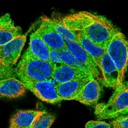 Immunofluorescent staining of human cell line Hep G2 shows localization to cytosol.