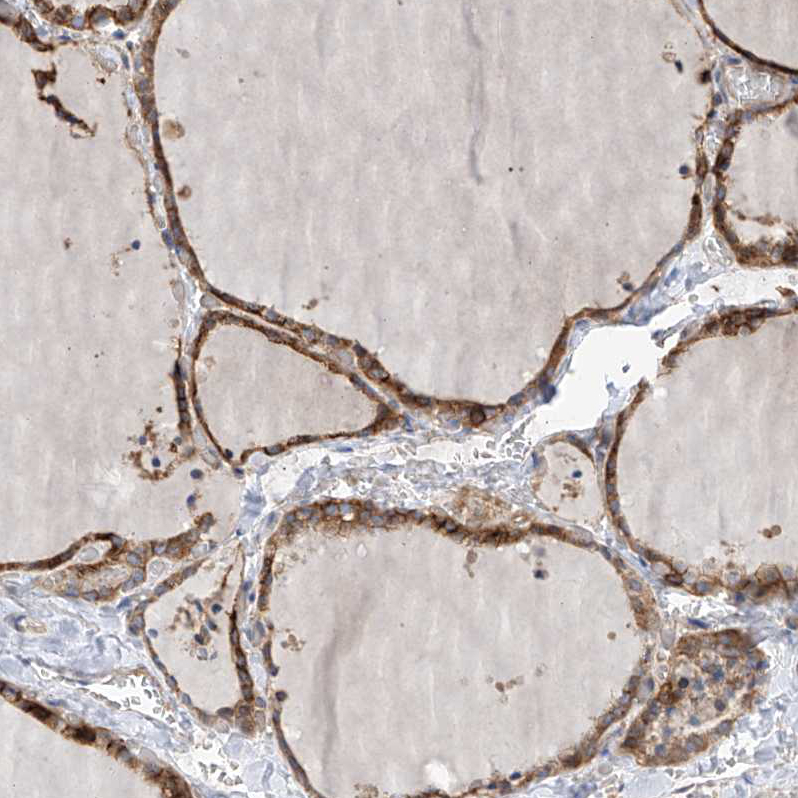 Anti-SLC43A3 Antibody