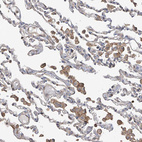 Anti-SLC43A3 Antibody