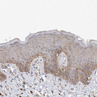 Anti-SLC43A3 Antibody