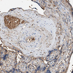 Anti-PRSS23 Antibody