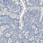 Anti-PRSS23 Antibody