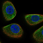 Immunofluorescent staining of human cell line hTCEpi shows localization to cytosol & intermediate filaments.