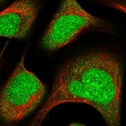 Immunofluorescent staining of human cell line U-2 OS shows localization to nucleus & cytosol.