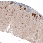 Anti-JAG2 Antibody