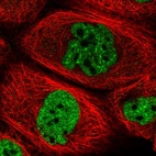 Immunofluorescent staining of human cell line A-431 shows localization to nuclear speckles.