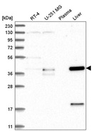 Anti-ZNF771 Antibody