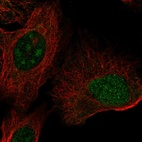 Anti-ZNF771 Antibody