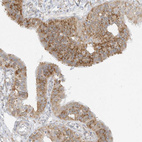 Anti-STT3A Antibody