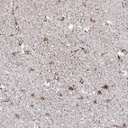 Anti-ARHGEF40 Antibody