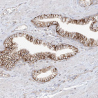 Immunohistochemical staining of human prostate shows strong membranous positivity in glandular cells.