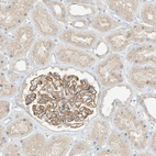 Immunohistochemical staining of human kidney shows strong membranous positivity in cells in glomeruli.