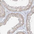 Immunohistochemical staining of human testis shows moderate cytoplasmic positivity in cells in seminiferous ducts.