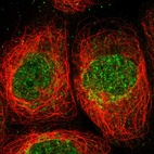 Immunofluorescent staining of human cell line A-431 shows localization to nucleoplasm & mitochondria.