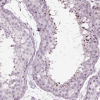 Anti-LRRIQ3 Antibody