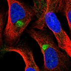 Anti-ZNF774 Antibody