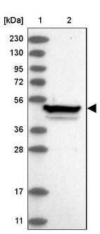 Anti-ZNF774 Antibody