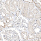 Anti-TAL2 Antibody