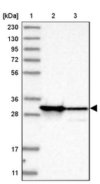 Anti-SARNP Antibody