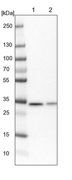 Anti-SARNP Antibody