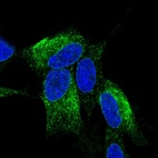 Anti-ZNF354C Antibody