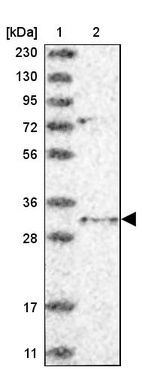 Anti-TSNAX Antibody