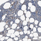 Anti-THEMIS2 Antibody