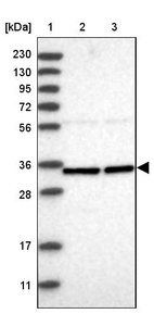 Anti-ZNF124 Antibody