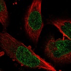 Anti-ZNF124 Antibody