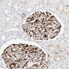 Anti-CDCP2 Antibody