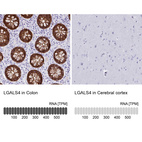 Anti-LGALS4 Antibody