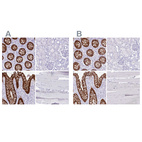 Anti-LGALS4 Antibody