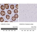 Anti-LGALS4 Antibody